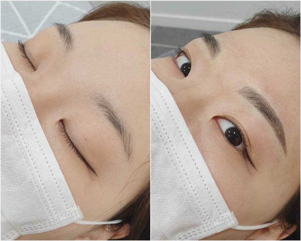 Chân mày sau 1 tuần điêu khắc sẽ bắt đầu quá trình bong vảy