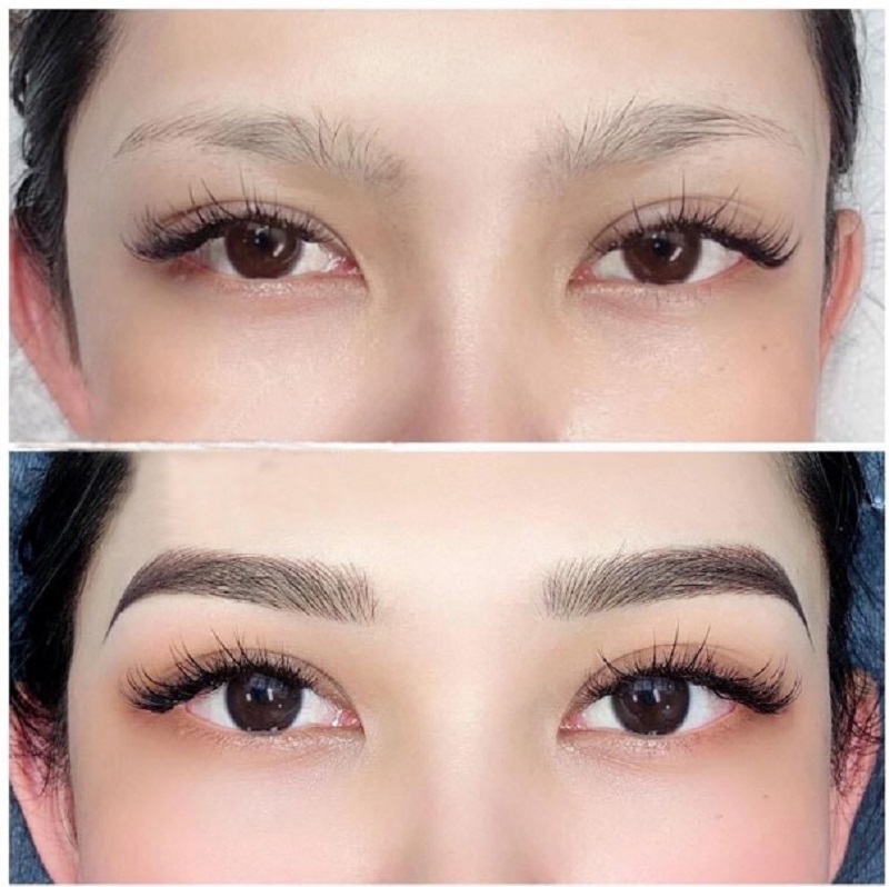 Viện Thẩm Mỹ Chivee ứng dụng nhiều kỹ thuật điêu khắc 