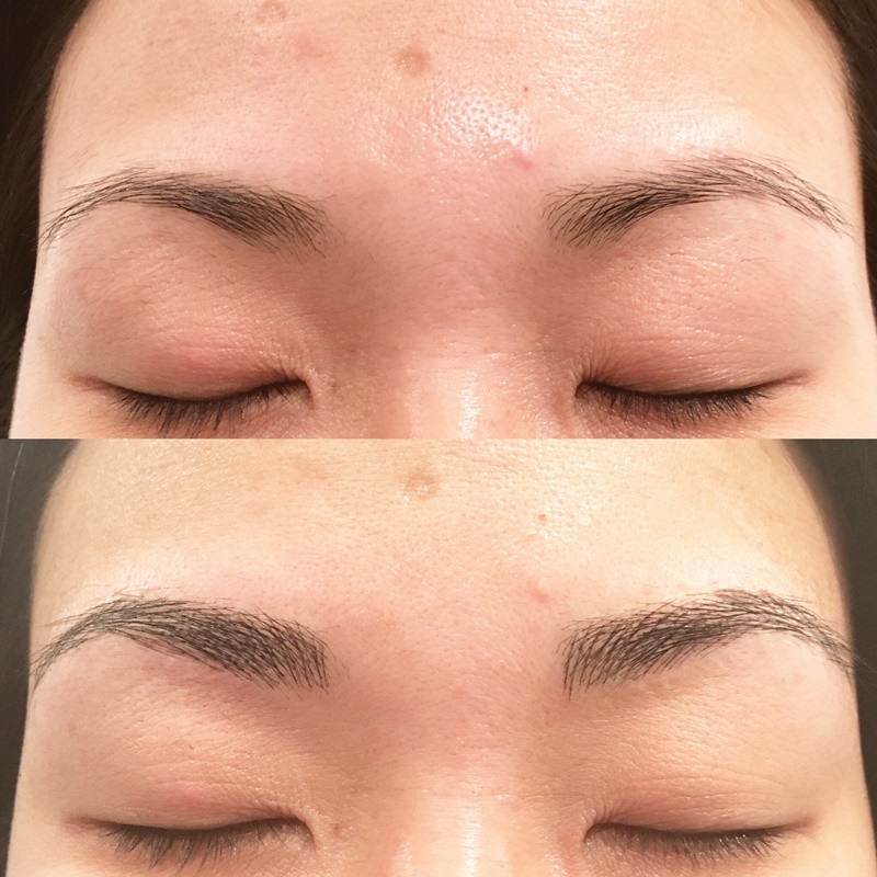 Kỹ thuật điêu khắc không chính xác làm rụng sợi lông mày
