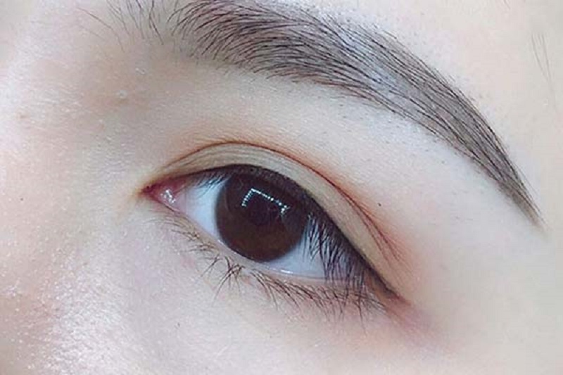 Những người có mắt 1 mí hay mí nhỏ hoàn toàn có thể thực hiện phun mí mở tròng