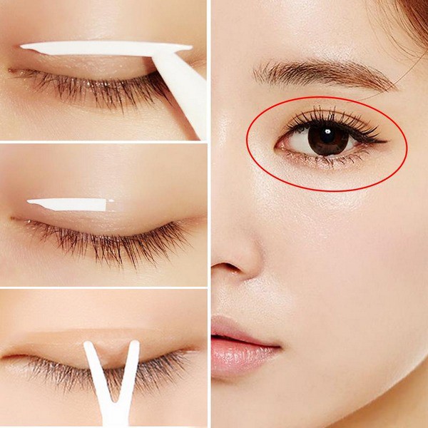 Phương pháp dán mí có thể mang lại hiệu quả tạm thời