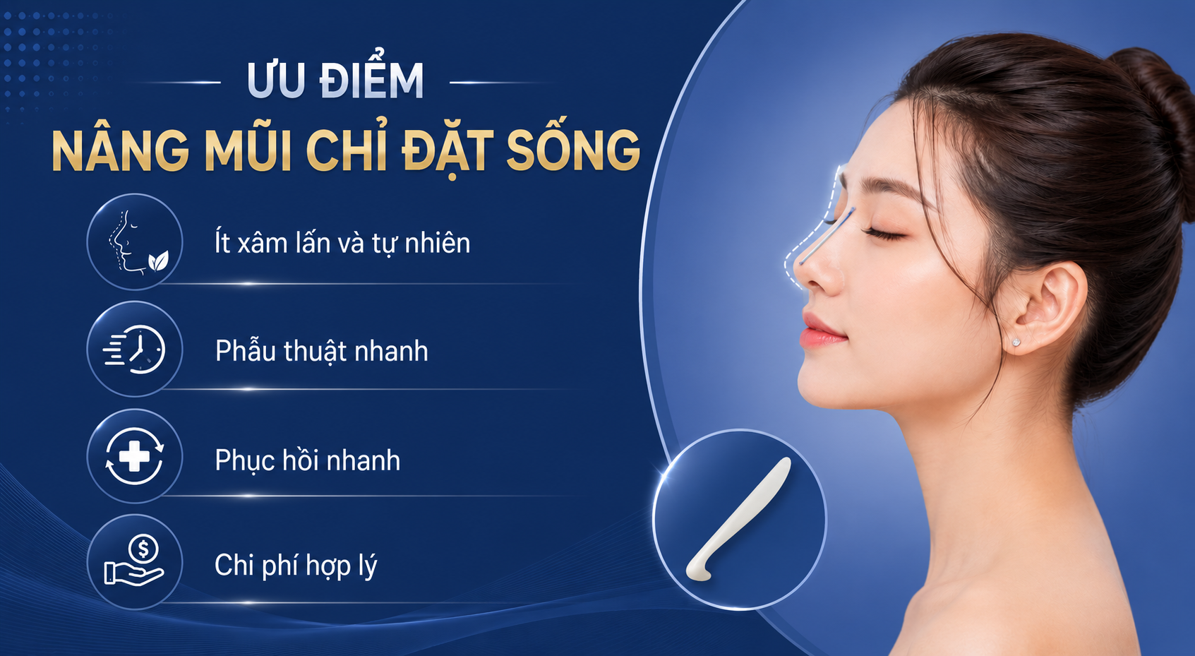 Ưu điểm nâng mũi chỉ đặt sống gồm ít xâm lấn, nhanh chóng, chi phí hợp lý