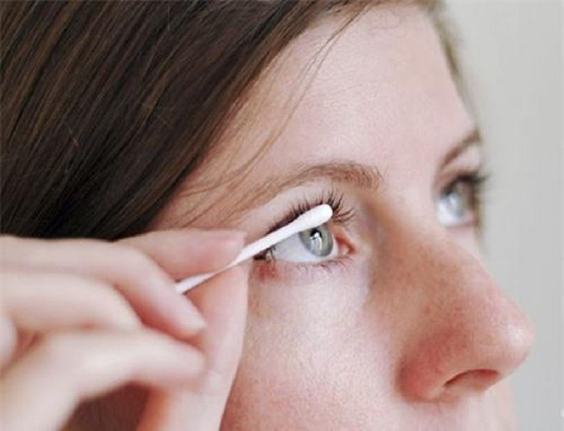 Vệ sinh mí mắt sạch sẽ hàng ngày bằng nước muối sinh lý