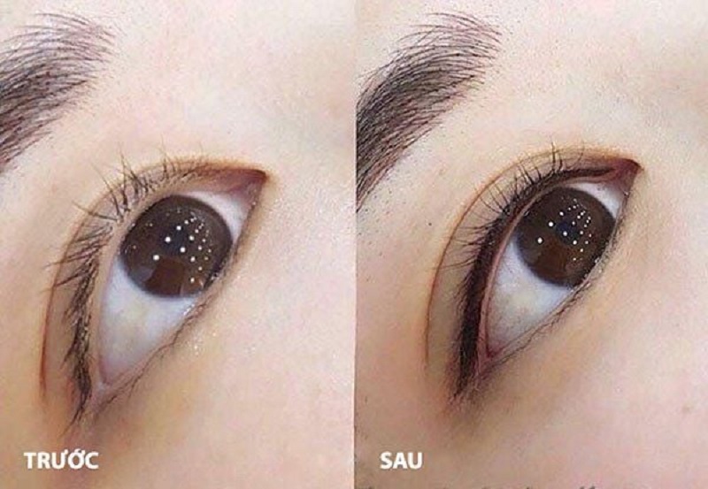 Mí mắt tự nhiên, không gây đau khi thực hiện