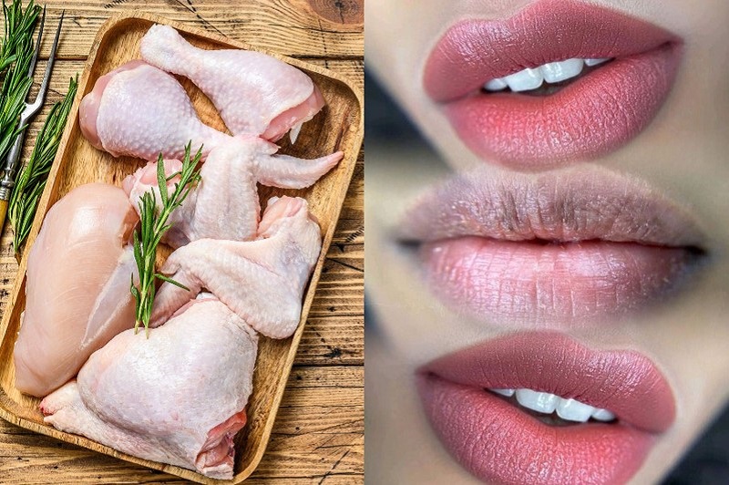 Thịt gà gây ngứa ngáy vết thương vùng môi