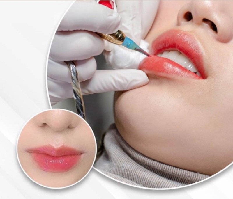 Phun xăm môi sử dụng đầu kim nhỏ để đưa mực phun vào da 