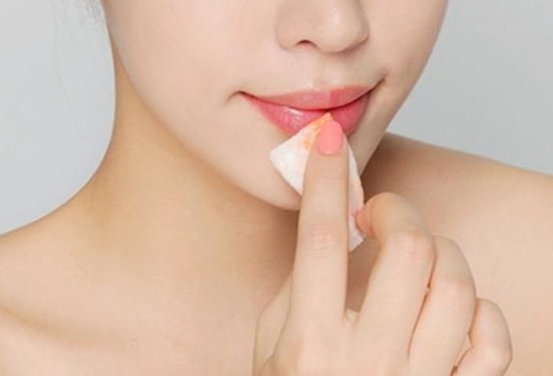 Nên chăm sóc môi đúng cách, vệ sinh sạch sẽ hàng ngày
