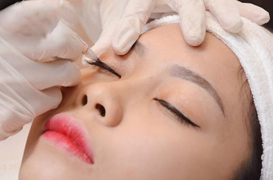 Có thể phun dặm lại mí mắt sau 1 thời gian