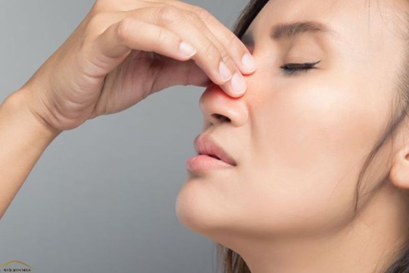 Cơ địa sẹo lồi dễ phản ứng với chỉ nâng mũi