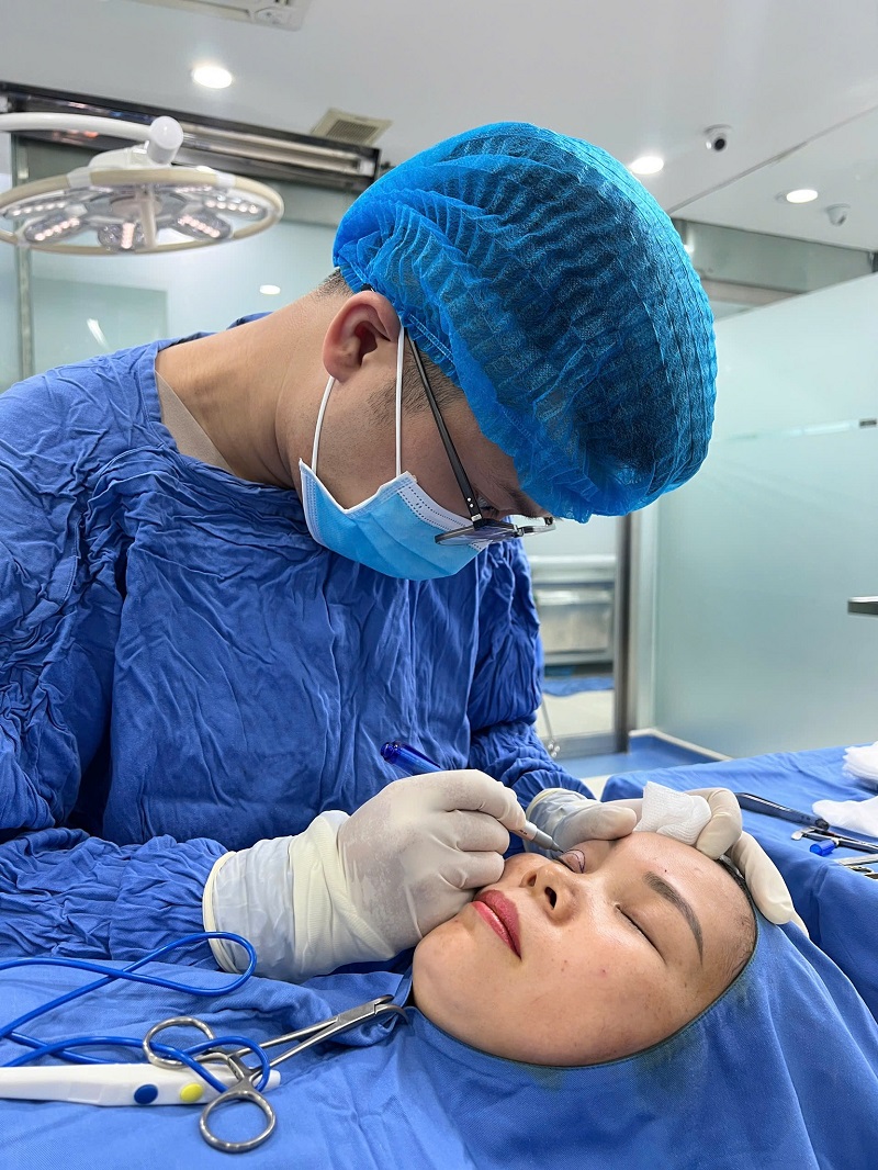Quá trình lấy mỡ mắt trên khách hàng được tiêm gây tê nên không gây đau