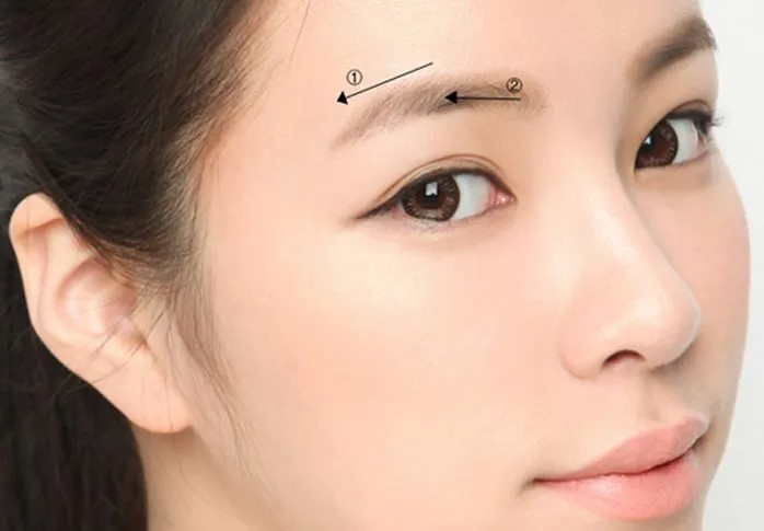 Nâng cung chân mày không phẫu thuật, không xâm lấn