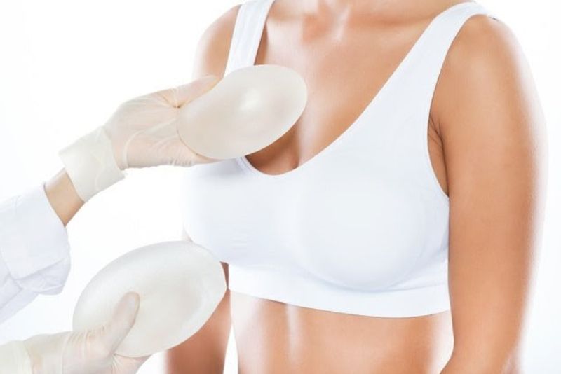 Nâng ngực nội soi túi Gsoft