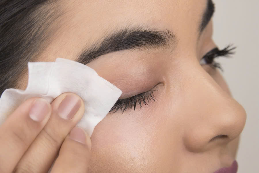 Nên vệ sinh vùng mí sạch sẽ hàng ngày