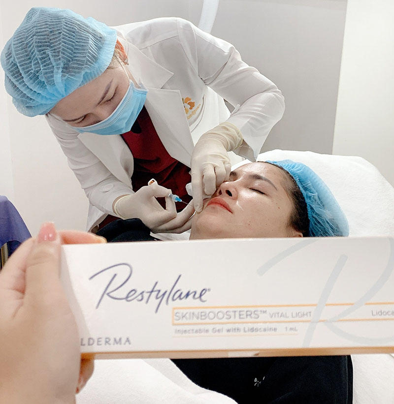 Kangnam sử dụng filler chất lượng, quy trình tiêm an toàn
