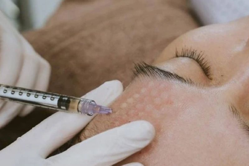 Đặc điểm làn da ban đầu quyết định khả năng duy trì kết quả