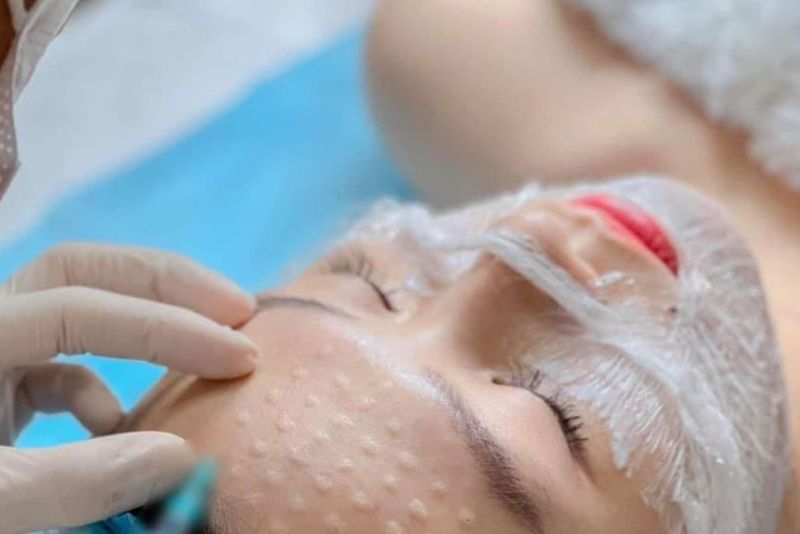 Hiện tượng bình thường sau tiêm meso