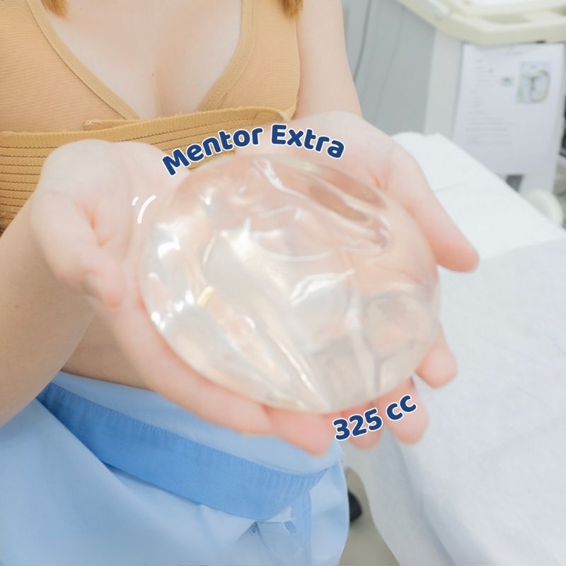 Size túi 325cc phù hợp với những người mong muốn có ngực đầy đặn rõ rệt