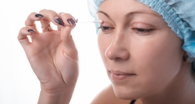 Làm sạch mí mắt theo chỉ định của bác sĩ