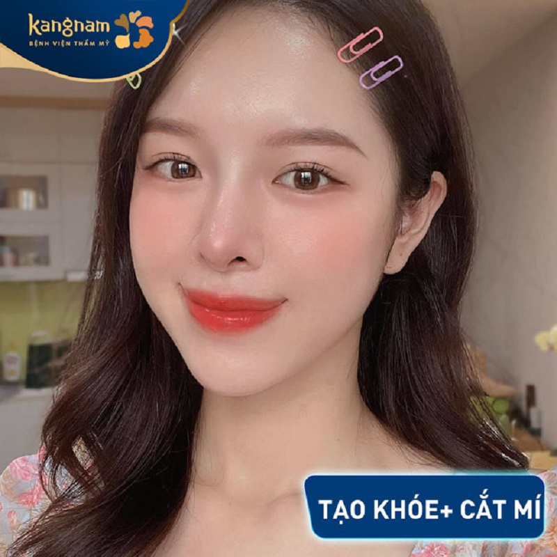 Sau tiểu phẫu đôi mắt cân đối, rõ nét hơn