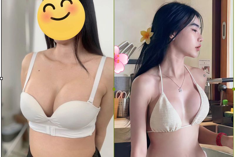 vòng một mềm mại tự nhiên sau nâng ngực túi giọt nước tại Kangnam