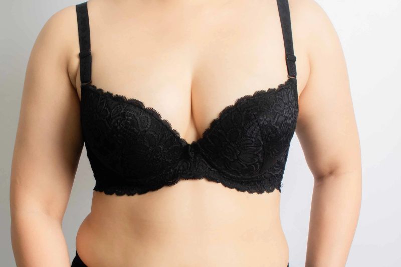 Ngực lệch bẩm sinh có thể nâng lệch size