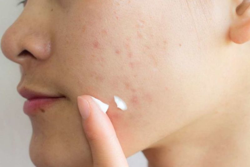 Chăm sóc da sau điều trị an toàn