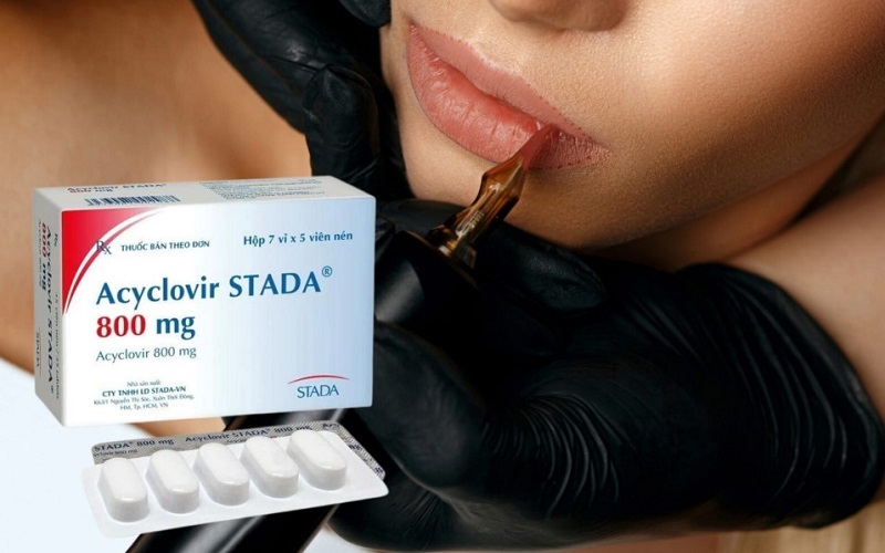 Dùng thuốc để kháng viêm, giảm thiểu sưng tấy sau phun môi