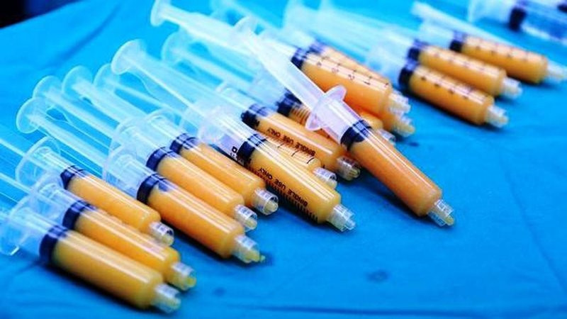 Nâng mông bằng mỡ tự thân giúp làm đầy vùng 3 săn chắc, to tròn