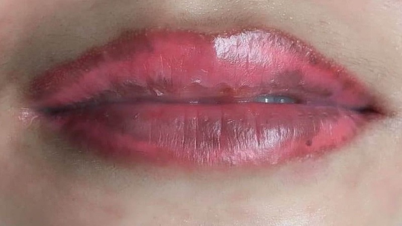 Màu môi loang lổ, lên không đều