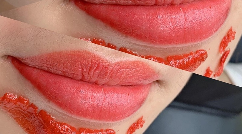 Để môi bong vảy tự nhiên, không nên tự bóc vảy làm tổn thương môi