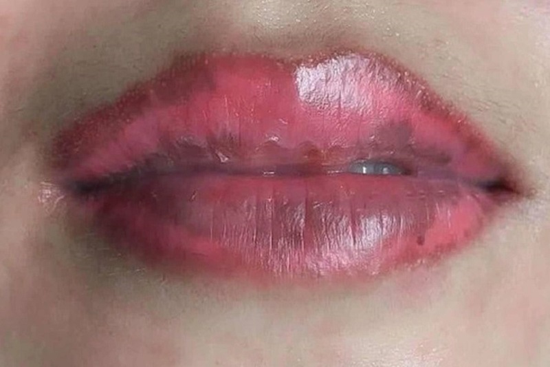 Ăn nước mắm quá sớm khiến môi dễ bị nhiễm trùng