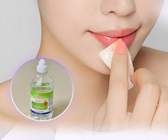 Nên vệ sinh môi sạch sẽ hàng ngày bằng nước muối sinh lý