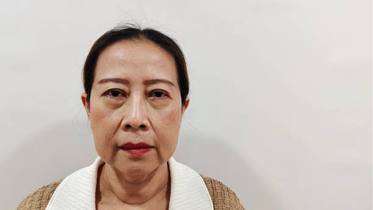 Hình ảnh nâng mũi khi về già, Cánh mũi có thể nở rộng nhẹ do sự thay đổi mô mỡ quanh vùng mặt