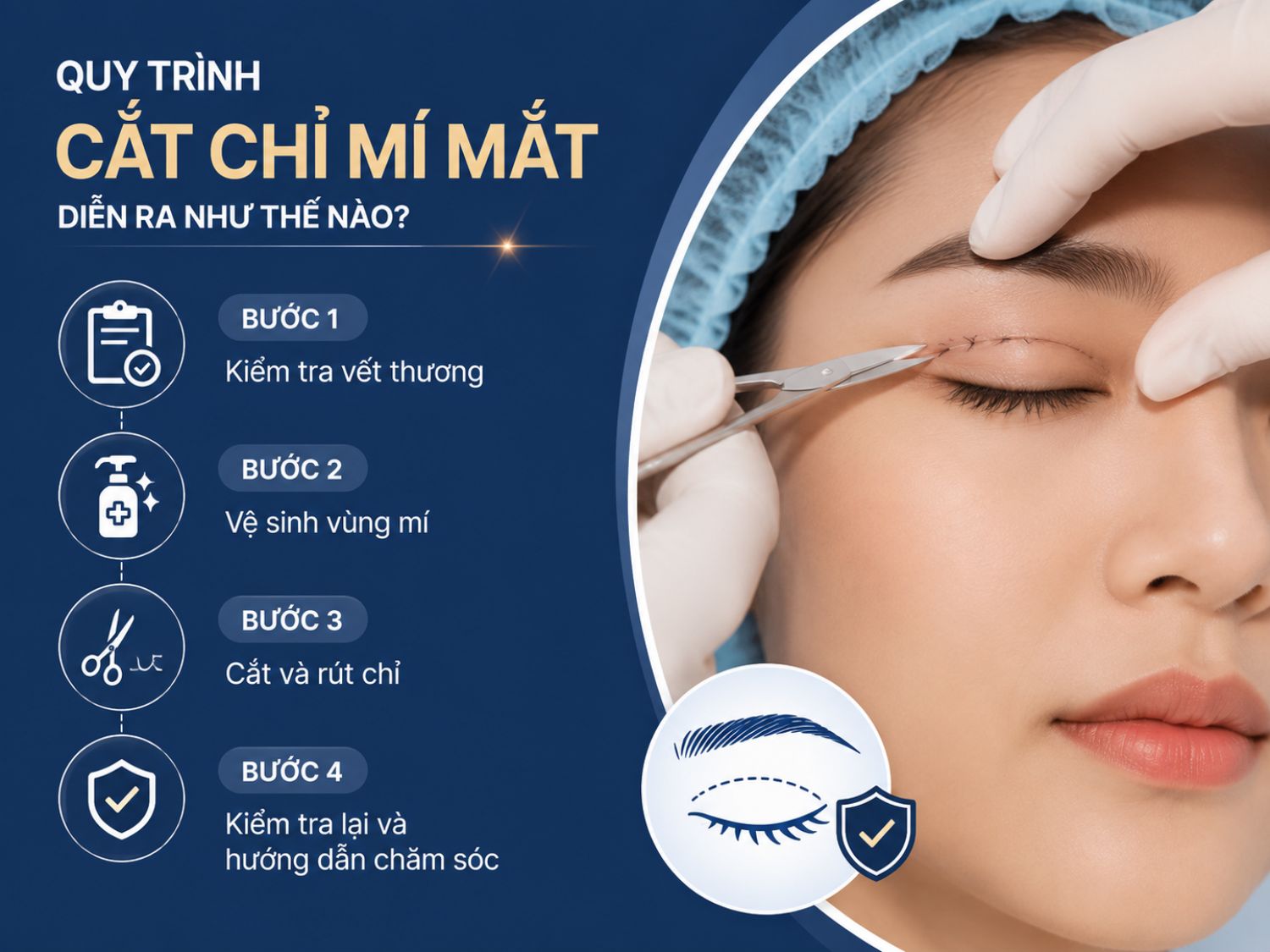 Quy trình cắt chỉ mí mắt thường diễn ra nhanh chóng và nhẹ nhàng, bao gồm kiểm tra tình trạng hồi phục, vệ sinh vùng mí và hướng dẫn chăm sóc để mí ổn định tốt hơn sau cắt chỉ.