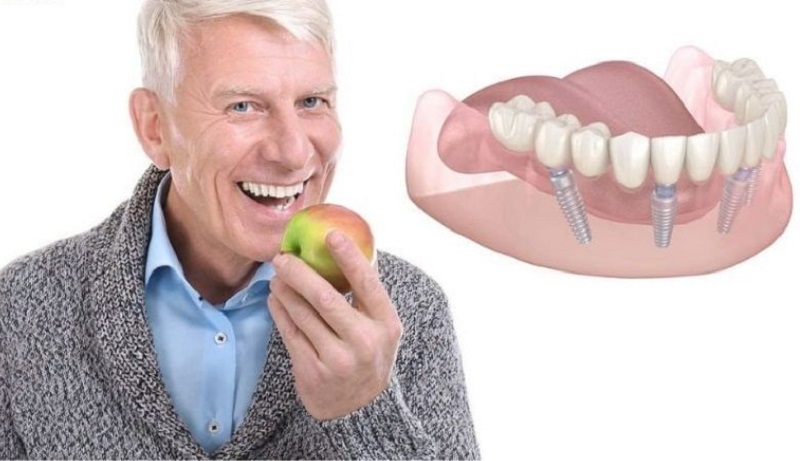Người lớn tuổi có thể trồng răng Implant