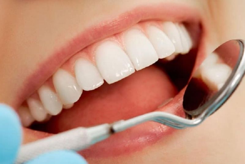 Bọc răng sứ kim loại