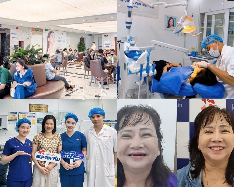 Bệnh viện Thẩm mỹ Kangnam là địa chỉ trồng răng Implant uy tín và chất lượng cao, chuẩn Y khoa tại TPHCM