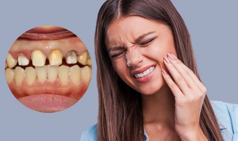 Những người mắc bệnh viêm nhiễm răng miệng thì chưa nên trồng Implant