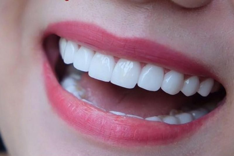 Thời gian phủ sứ nano nhanh chóng