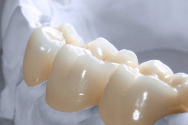 Zirconia Cercon