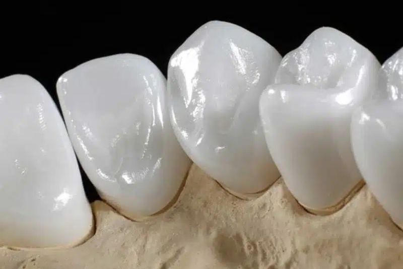 Có nhiều loại răng sứ Zirconia khác nhau
