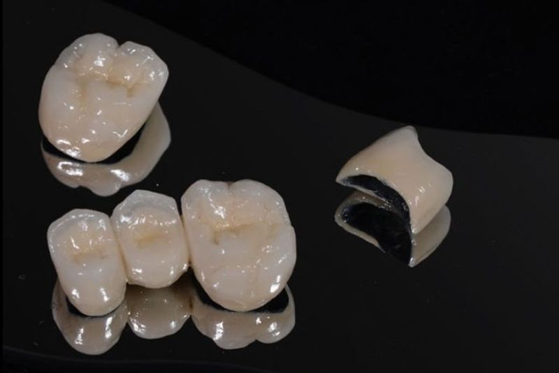 Răng sứ Titan Margin