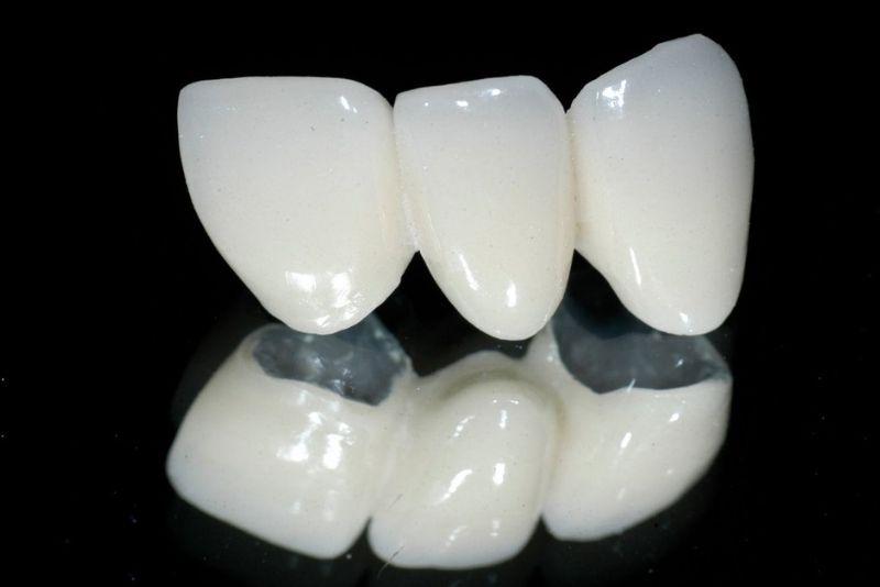 Răng sứ Titan Berlin