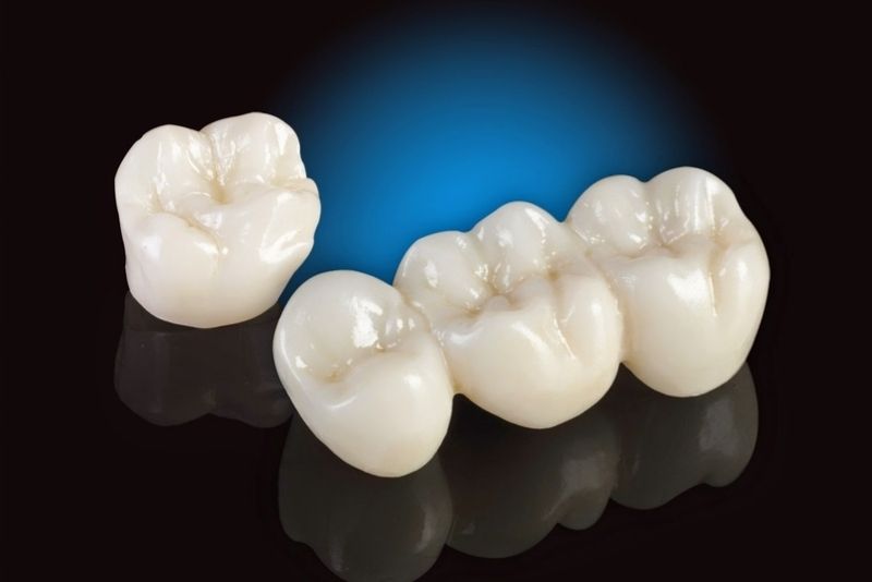 Răng sứ Titan có nhiều loại khác nhau