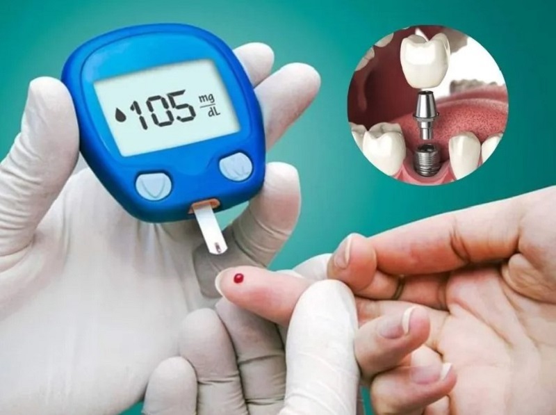 Bệnh tiểu đường kiểm soát tốt có thể trồng Implant