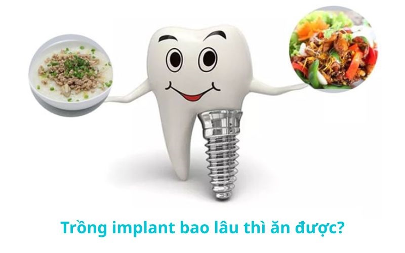 Sau trồng răng khách hàng nên chú ý đến chế độ ăn uống