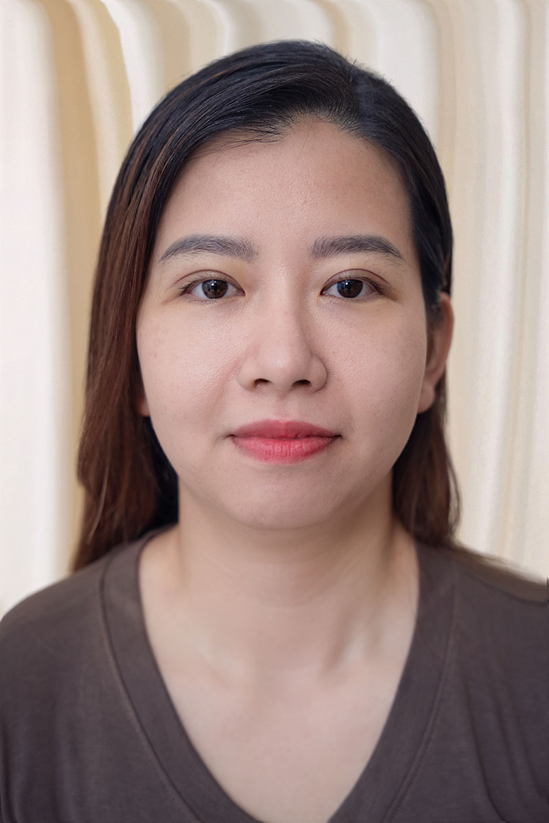 Cận cảnh nếp mí ổn định, tự nhiên không tỳ vết của khách hàng Hồng Thủy sau 1 tuần.