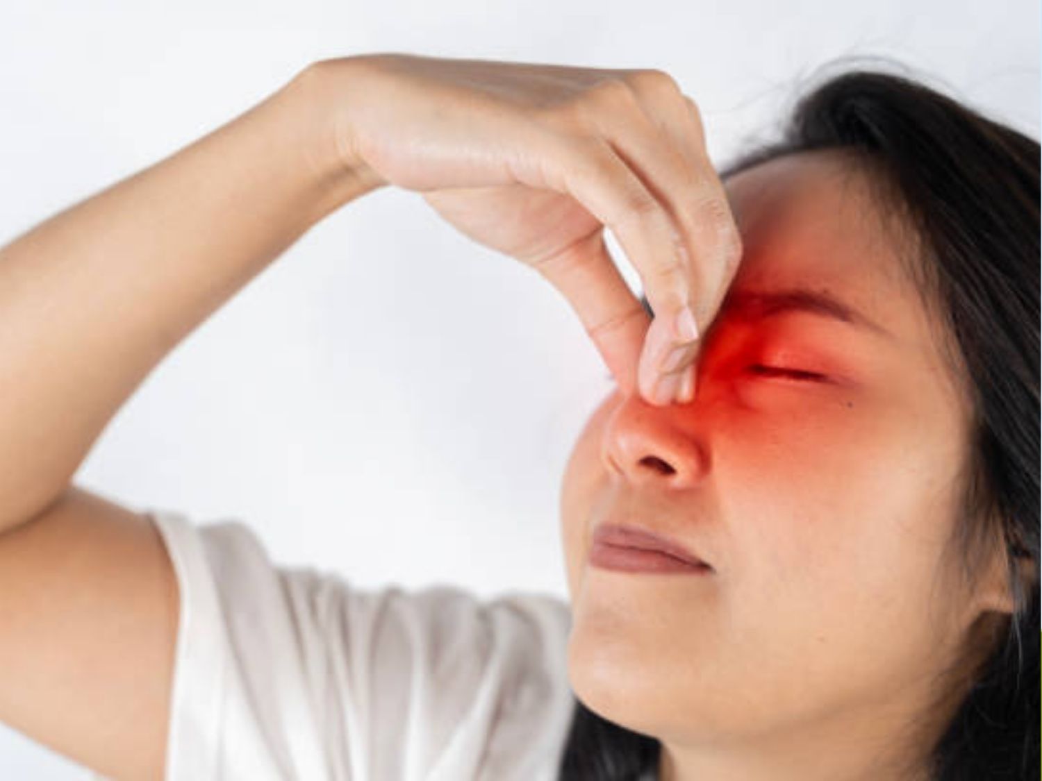 Bóng đỏ, lộ sóng mũi do chọn sai phương pháp nâng mũi