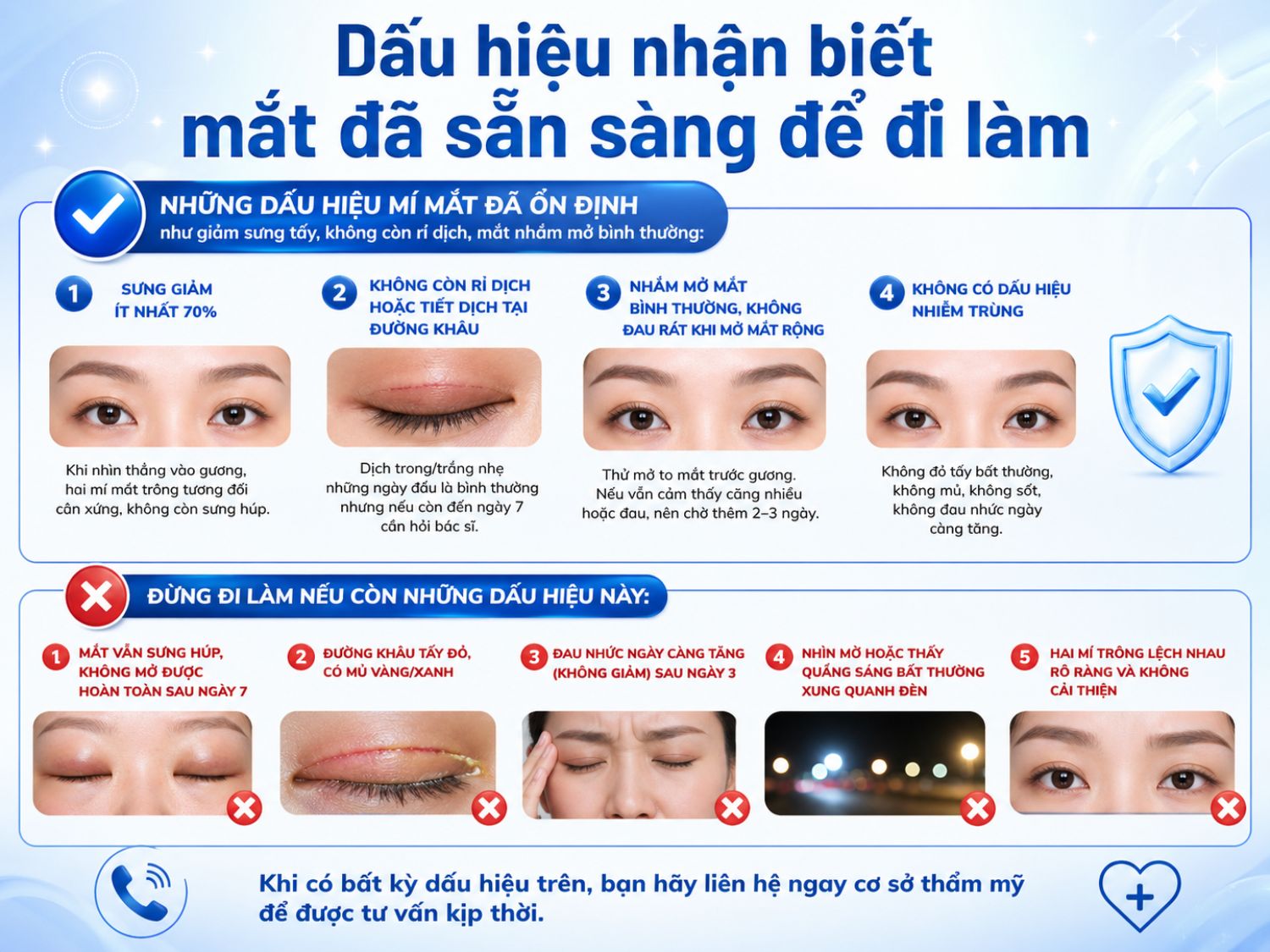 Nhận biết thời điểm mắt ổn định sau cắt mí để quay lại công việc an toàn – tránh biến chứng và đảm bảo kết quả thẩm mỹ tối ưu