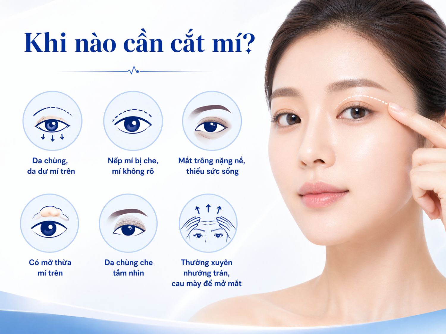 Nhận diện tình trạng da chùng, mỡ thừa khiến đôi mắt trông nặng nề.